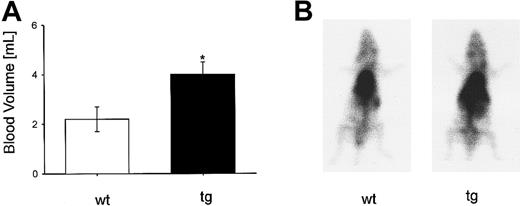 Fig. 4. Blood volume determination and visualization using99mTc-labeled red blood cells. / (A) Adult tg mice had a 75% increase of blood volume (wt: n = 4; tg: n = 5), *P < .05. (B) Planar scintiscan showing an increased radioactivity of the tg mouse in the areas of the heart, lung, liver, and left abdomen, where the more than 4-fold (data not shown) enlarged spleen was situated.