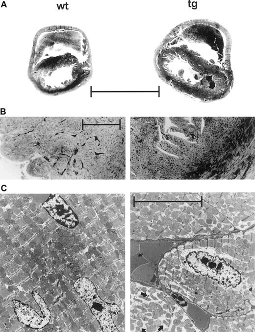 Fig. 8. Representative histology of the adult heart. / (A) Cross section at the level of the pars muscularis of the interventricular septum. Tg hearts were enlarged with biventricular dilatation and hypertrophy of the free walls. (Hematoxylin-eosin stain; magnification ×3.5, scale 3 mm.) (B) Prominent hyperemia of the capillaries packed with erythrocytes in the tg heart. (Trichrome; magnification ×106, scale 200 μm.) (C) Transmission electron micrograph showing marked intracellular edema in cardiomyocytes of the tg heart (arrows, lower right part). (Magnification ×8300, scale 5 μm.)