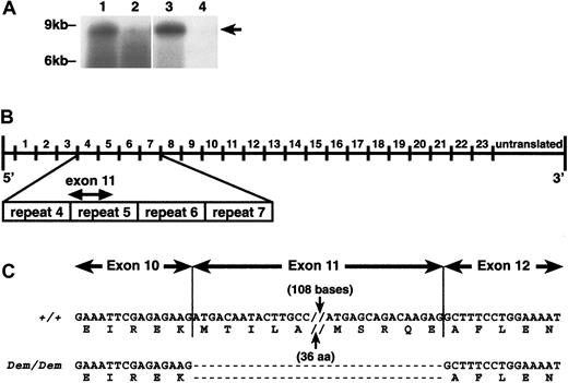 Fig. 3. Analysis of. / sphDem/sphDem cDNA sequence. (A) Northern blots of total RNA from spleen (lanes 1, 2) and reticulocytes (lanes 3, 4) of +/+ (lanes 1, 3) andsphDem/sphDem (lanes 2, 4) mice. UV shadowing was used to check RNA loading. Size markers are indicated on the left. Arrow on right identifies the +/+ 8-kb transcript. (B) Schematic representation of the Spna1 cDNA with numbers above the line corresponding to the repeats of 106 aa that comprise the α-spectrin protein. Shown below the cDNA schematic is an enlargement of repeats 4 through 7 of α-spectrin, with the location of exon 11 identified. (C) α-Spectrin cDNA sequence obtained from spleen RNA of wild type (+/+) and sphDem/sphDem(Dem/Dem) mice. Shown directly below each cDNA sequence is the corresponding protein sequence. Note the lack of exon 11 sequence in the cDNA from sphDem/sphDem mice and that this deletion does not alter the translational reading frame.