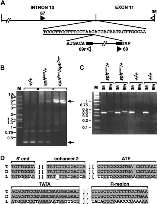 Fig. 4. Analysis of. / sphDem/sphDem genomic DNA. (A) Top line, schematic of intron 10 and exon 11 of theSpna1 gene. Vertical lines denote exon/intron boundaries. Second line, normal sequence at the intron 10/exon 11 boundary; intron sequence is underlined. The IAP element present in thesphDem allele is shown on the third line, flanked by its LTR sequences (black boxes). The 6 bases preceding the IAP element on the third line represent exon 11 sequence duplicated by insertion of the element. Double hatch (//) marks denote sequence not represented in the figure. Filled and open triangles show the location of forward and reverse PCR primers, respectively. Sequence of PCR primers 67, 35, and 69r is found in the “Materials and methods” section; primer 69 is the complement of primer 69r. (B) Long PCR of genomic DNA from +/+ (lanes 2, 3), sphDem/+ (lanes 4, 5), and sphDem/sphDem(lanes 6, 7) mice with primers 67 and 35. M, marker lane, sizes of markers in kb are indicated on left. Top arrow on right identifies the 5.75-kb band resulting from amplification of the insert-containingsphDem allele of Spna1. Bottom arrow on right identifies the 0.35-kb band resulting from amplification of the normal allele of Spna1. (C) Genomic PCR of tail DNA from 2 different +/+ and sphDem/+ mice. Lane M is marker; sizes in kb are shown on left. Lanes ‘35’: PCR products from a reaction containing primers 67 and35 that will amplify the wild type allele of Spna1. Lanes ‘69r’: PCR products from a reaction containing primers (67 and 69r) designed to identify the IAP insertion in the sphDem allele. Genotype of mice is noted above each bracketed pair of reactions. (D) ThesphDem IAP is in the T subclass. Sequences of LTR elements derived from LS-type (‘L’, bottom line)24and T-type (‘T’, top line)2526 IAP elements compared to that of the IAP element inserted in intron 10 of thesphDem allele of Spna1 (‘D’, middle line). The regions of sequence shown are used to classify IAP elements.24 Shaded bases represent sequence identity; nonshaded bases represent sequence divergence.