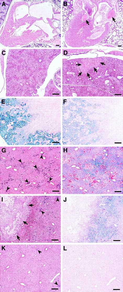 Fig. 5. Histopathology of neonatal and adult. / sphDem/sphDem mice.Histological sections of heart, liver, and kidney fromsph/sph and sphDem/sphDemmice. Bars = 20 μm. (A, C, E, G, H): sph/sph. (B, D, F, I, J, K, L): sphDem/sphDem. (A,B): Heart sections of neonates stained with H&E. Note the presence of thrombi (indicated by arrows) in the valve and atrium of (B). (C,D): Liver sections from neonates stained with H&E. Note the presence of an infarcted region (identified by arrows) in (D). (E,F): Kidney sections from adult mice, stained with Gomori iron stain, which stains nonhemoglobin iron blue. (G,I,K): Liver sections from adult mice stained with H&E. Clusters of extramedullary hematopoiesis (arrowheads) stain purple. Arrows in (I) identify a large calcified lesion indicative of earlier infarction. (H,J,L): Identical regions of liver as shown in (G,I,K), stained with Gomori iron stain.
