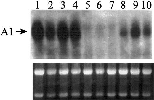 Fig. 1. Northern analysis for human A1 mRNA expression. / WT U937 cells or U937 cells transfected with pLSXN retroviral vector or pLXSN containing Bcl-2 in the sense orientation were exposed to 1 μg/mL bleomycin, which induces myeloid differentiation in these cells (increased granularity and CD11b expression), and assayed for the expression of A1 mRNA. Approximately 20 μg total RNA was loaded in each lane. IL-1–treated A549 lung carcinoma cell line was included (lane 1) for positive control. Other experimental groups included WT U937 cells that were either untreated or treated with bleomycin for 2 and 5 days (lanes 2, 3, and 4, respectively); U937 cells expressing Bcl-2 that were either untreated or treated with bleomycin for 2 and 5 days (lanes 5, 6, and 7, respectively); and vector-transfected U937 cells that were either untreated or treated with bleomycin for 2 and 5 days (lanes 8, 9, and 10, respectively). Northern blot was hybridized to a randomly primed32P-labeled A1 cDNA. Autoradiograph was developed after 6 days exposure to x-ray film using 2 intensifying screens at − 80°. Photograph of the corresponding ethidium bromide–stained gel is shown below the autoradiograph for loading control.