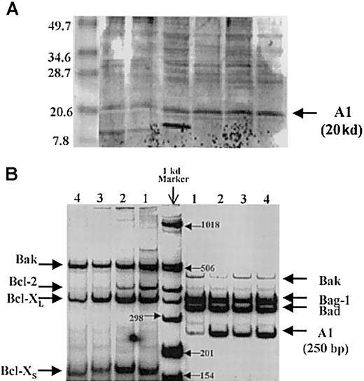 Fig. 1-1. A1 detection by Western blot analysis and reverse-transcriptase polymerase chain reaction. / (A) Detection of A1 by Western blot analysis. The A1 bands are at the correct location of 20 kd. (B) Detection of A1 mRNA by reverse-transcriptase polymerase chain reaction (RT-PCR) in primary AML samples.