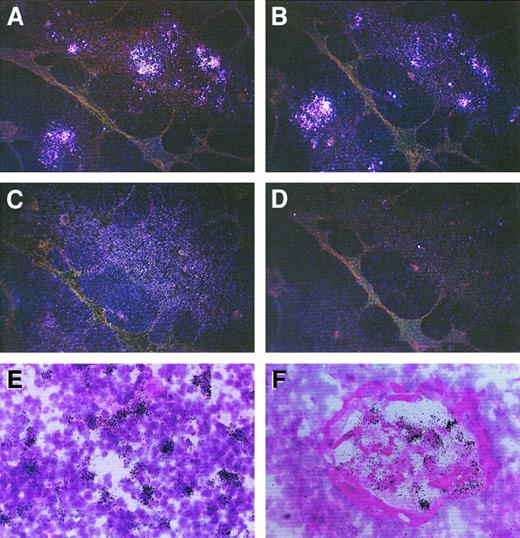 Fig. 1. In situ hybridization showing expression of IP-10, Mig, and I-TAC mRNA in human thymus. / Consecutive thymic sections were hybridized with35S-labeled IP-10, Mig, or I-TAC antisense or sense probes. Positive signal with the IP-10 (A), Mig (B), and I-TAC (C) antisense probes (dark field, original magnification × 40) is visible mainly in the medullary areas, whereas virtually no signal is visible with the I-TAC sense probe (D) (dark field, original magnification × 40) as well as with the IP-10 or Mig sense probes (data not shown). The IP-10 signal is especially localized in single cells scattered in the medulla (E), whereas the Mig signal predominates at the level of Hassall corpuscles (F) (bright field, original magnification × 400).