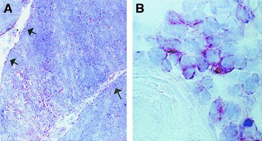 Fig. 3. Localization of CXCR3-expressing cells in human thymus. / (A) CXCR3 expression in the medulla and in cells of subcapsular areas, as indicated by arrows (original magnification × 100). (B) Higher magnification of medullary CXCR3-expressing cells localized in proximity to a Hassall corpuscle (original magnification × 1000). Sections were immunostained with anti-CXCR3 Ab using the avidin-biotin-peroxidase method. One representative experiment is shown.