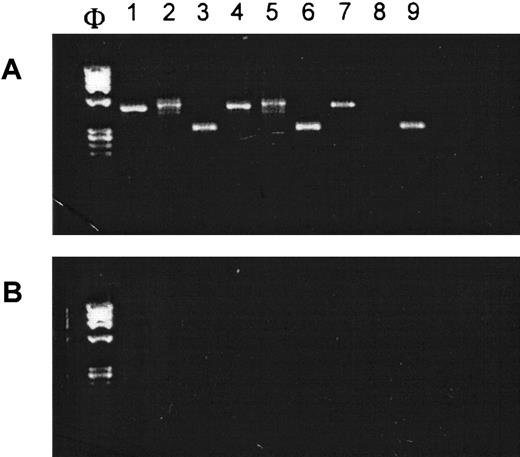 Fig. 5. GST mRNAs are expressed in human CFU-GM–, BFU-E–, and CFU-Meg–derived cells. / (A) RT-PCR analysis on mRNA expression for GSTM1 (lanes 1, 4, and 7), GSTT1 (lanes 2, 5, and 8) and β-actin (lanes 3, 6, and 9) in human CFU-GM–derived (lanes 1-3), CFU-Meg–derived (lanes 4-6), and BFU-E–derived (lanes 7-9) cells. (B) Negative RT-PCR control reactions (H20 in place of mRNA). Experiment was repeated 3 times with similar results.