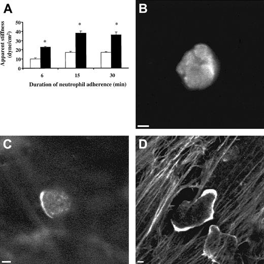 Fig. 1. Apparent stiffness of neutrophils and distribution of neutrophil F-actin when neutrophils were adherent to 24-hour TNF-α–treated ECs or untreated ECs. / After the TNF-α was washed off, the apparent stiffness of the neutrophils was measured using magnetic twisting cytometry, and F-actin was visualized using rhodamine-phalloidin stain as described in “Materials and methods.” (A) Apparent stiffness of neutrophils when they were adherent to TNF-α–treated ECs (▪) or untreated ECs (■) for the indicated times. (B) F-actin distribution in nonadherent neutrophils. (C) F-actin distribution in neutrophils bound to untreated ECs for 15 minutes. (D) F-actin distribution in neutrophils adherent to 24-hour TNF-α–treated ECs for 15 minutes. The stiffness measurement is presented as mean ± SEM of at least 5 separate experiments. *P < .05 when compared with neutrophils bound to untreated ECs. Scale bars, 2 μm.