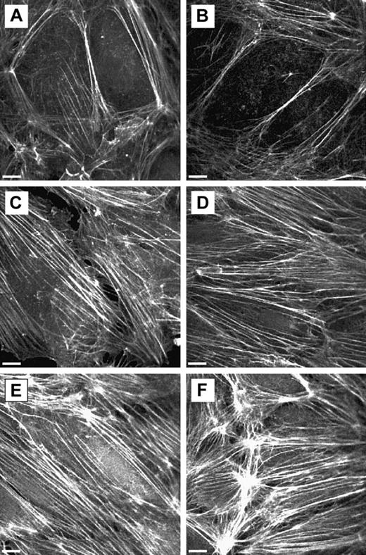 Fig. 6. F-actin distribution in untreated or 24-hour TNF-α–activated ECs on neutrophil adherence. / F-actin was visualized using rhodamine-phalloidin stain as described. (A) Untreated ECs. (B) Untreated ECs with neutrophil adherence for 15 minutes. (C) Twenty-four-hour TNF-α–activated ECs. (D-F) Twenty-four-hour TNF-α–activated ECs with neutrophil adherence for 2, 6, and 10 minutes. Scale bars, 10 μm.