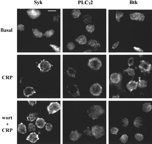 Fig. 1. CRP induces PI 3-kinase–dependent translocation of PLCγ2 and Btk or PI 3-kinase–independent translocation of Syk in human platelets. / Human platelets, stimulated by CRP (4 μg/mL) for 150 seconds, were fixed and stained for Syk, PLCγ2, or Btk as described in “Materials and methods” to study the protein localization. Platelets were pretreated with wortmannin (wort) 100 nM for 15 minutes before the stimulation by CRP to investigate the role of PI 3-kinase. Scale bar = 2 μm.