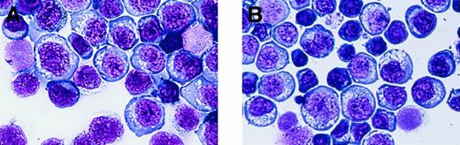 Fig. 3. Morphology. / Established cell lines show rich cytoplasmic vacuoles and no azurophilic granules. (A) SNK-6. (B) SNT-8. (Wright-Giemsa, final magnification × 440)