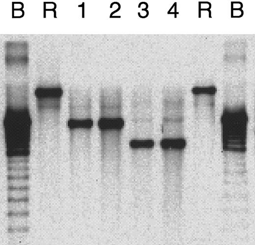 Fig. 6. Clonality of EBV. / Southern blot analysis for clonality of EBV as evidence for monoclonal expansions of EBV-positive cells in primary tumor in patient 1 (lane 1), SNK-6 cells (lane 2), primary tumor in patient 2 (lane 3), and SNT-8 cells (lane 4). Controls are B95-8 cells (B) and Raji cells (R) for cells with monoclonal EBV expansion and polyclonal EBV replication, respectively.