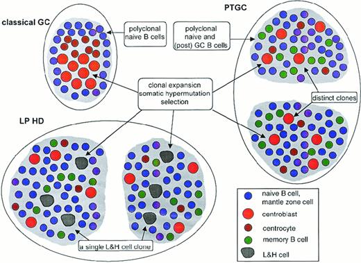 Fig. 2. Schematic comparison of classical GC, PTGC, and LPHD. / Shown are a classical GC, 2 PTGCs, and 2 follicular structures in an LPHD lymph node. Depicted are the main B-cell types in these structures, namely naive B cells (ie, mantle zone cells in the classical GC), centroblasts, centrocytes, memory B cells, and lymphocytic and histiocytic cells of LPHD. T-helper cells and follicular dendritic cells, which are present in each of the 3 structures, are not shown. Ongoing somatic hypermutation in the lymphocytic and histiocytic cells has been observed in approximately half the patients. The composition of the population of small resting B cells in the LPHD is hypothetical.