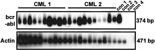 Fig. 4. Results showing that growth factor–independent G0 cells are exclusively. / BCR-ABL+. RT-PCR analysis ofBCR-ABL and actin expression was done on 20 clones derived from single, initially quiescent CD34+ cells (10 each from patients 1 and 2) after culture for 10 days in the absence of added growth factors. PCR products were hybridized by using complementary DNA probes specific for BCR-ABL and actin, respectively. Con 1, 1000 CML cells; con 2, 1000 normal bone marrow cells; con 3, 1000 CML cells without reverse transcriptase; con 4, water.