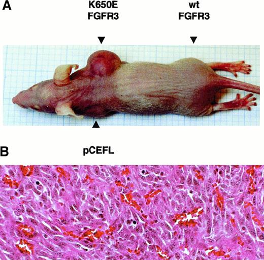 Fig. 5. Tumorigenicity of K650E expressing NIH 3T3 cells in nude mice. / . (A) 105, 5 × 105, and 9 × 105 NIH 3T3 cells transfected with pCEFL (upper left flank), K650E (upper right flank), and wild-type FGFR3 (lower right flank) were subcutaneously injected into 6-week-old nude mice. A representative mouse that received 9 × 105 cells is shown 19 days after the injection. (B) Microscopic appearance of a section of K650E expressing tumor tissue stained with hematoxylin and eosin. An abundance of blood vessels is shown.
