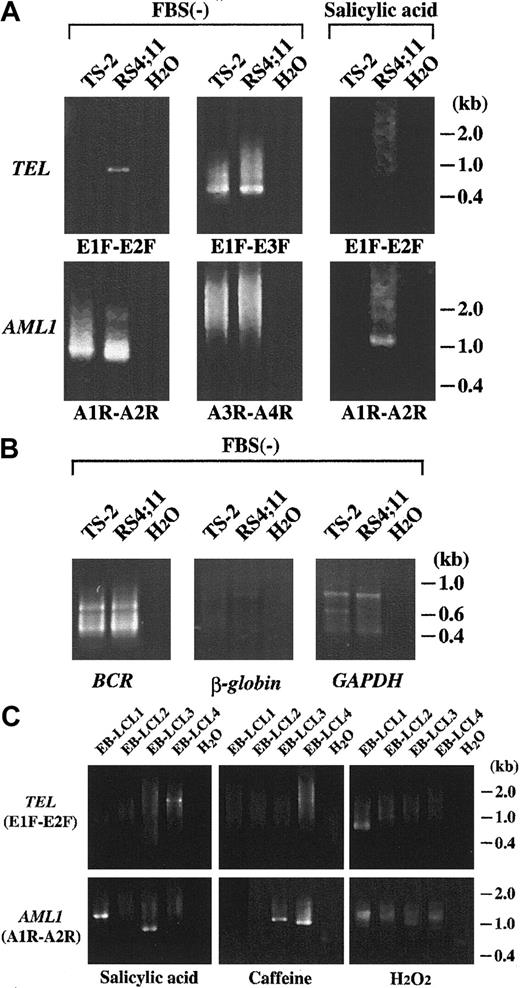 Fig. 2. DSBs of. / TEL and AML1 genes as detected by LM-PCR. Representative results of LM-PCR are shown. PCR products were electrophoresed on 2% agarose gels and stained with ethidium bromide. (A) DSBs of TEL and AML1 genes in TS-2 and RS4;11 cell lines. Gene-specific primers used for seminested PCR are indicated in each panel. FBS(−) indicates cells treated with serum starvation; salicylic acid, cells treated with salicylic acid as described in “Materials and methods.” (B) Representative results of LM-PCR for BCR,β-globin, and GAPDH genes in TS-2 and RS4;11 cell lines. Primers used for LM-PCR are listed in Table 1. (C) DSBs ofTEL and AML1 genes in EB-LCLs after treatment with various chemical agents. Primers used for seminested PCR were indicated in parentheses. H2O represents negative control.