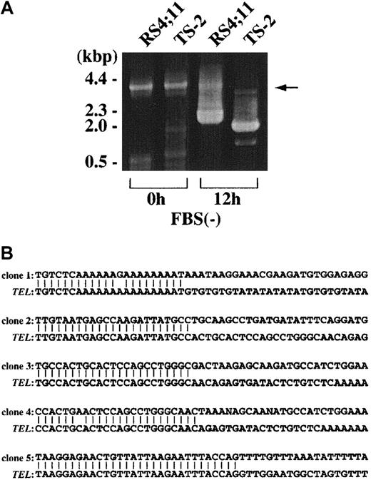 Fig. 4. Inverse PCR analysis of rearranged. / TEL gene after serum starvation. (A) Representative results of inverse PCR-amplified fragments of the rearranged TEL gene after serum starvation. PCR products were electrophoresed on 0.8% agarose gels and stained with ethidium bromide. Control samples obtained before serum starvation (0 hour) show only normal products derived from the 4-kb HindIII fragment (arrow). Samples from 12 hours of serum starvation culture show rearranged products with smaller size than the germline band in RS4;11 and TS-2. (B) Nucleotide sequences of the breakpoints of theTEL gene and unknown sequences fused to DNA break ends in 5 rearranged clones.