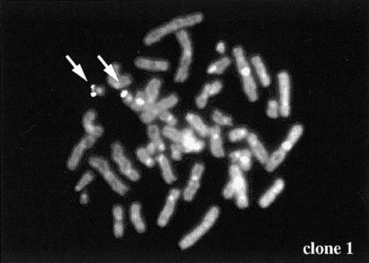 Fig. 5. Chromosome mapping of a partner gene fused to the. / TEL gene. One of the partner genes (clone 1 in Figure 4B) was determined to be located on chromosome 19 by FISH. Arrows indicate FISH signal of the gene.