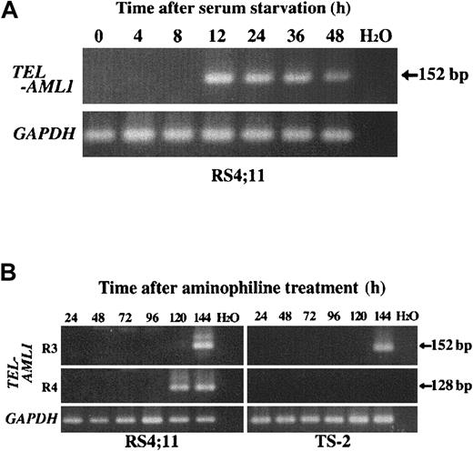 Fig. 6. TEL-AML1 fusion transcript as detected after serum starvation and aminophylline treatment by RT-PCR. / (A) Representative results of RT-PCR of RS4;11 cell line at various time points after serum starvation. TEL exon 5 forward primers (TEL940f and TEL981f) and AML1 exon 3 reverse primers (AML1-r31 and AML1-r32) were used in nested PCR analysis for TEL-AML1 fusion transcript. (B) Representative results of RT-PCR of RS4;11 and TS-2 cell lines at various time points after treatment with aminophylline. TELexon 5 forward primers (TEL940f and TEL981f) and AML1 exon 3 or exon 4 reverse primers (R3: AML1-r31 and AML1-r32, R4: AML1-r41 and AML1-r42, respectively) were used in nested PCR for TEL-AML1fusion transcript. H2O represents negative control in both panels A and B.