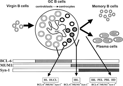 Fig. 4. Proposed model for the histogenesis of HIV-related lymphomas. / This model is based on the physiologic stages of mature B-cell development identified by histogenetic markers, such as mutation pattern of immunoglobulin variable region genes (IgV) andBCL-6 gene and expression profile of BCL-6, MUM1, and CD138/syn-1 proteins (rectangles). Virgin B cells do not display immunoglobulin or BCL-6 mutations and lack protein expression of BCL-6, MUM1, and syn-1. At the time of B-cell transit through the GC, B cells acquire IgV and BCL-6 mutations, which are maintained during further differentiation, thus constituting genotypic markers of GC transit.101113 B cells within the GC (ie, centroblasts and centrocytes) express BCL-6 but not syn-1.1 Post-GC B cells undergoing maturation toward the plasma cell stage switch off BCL-6 expression and stain positive for syn-1. Based on the results of this study, the histogenetic model presented in the figure has been enriched by the addition of the MUM1 marker, which is expressed by late stages of intra-GC differentiation (centrocytes) and by post-GC B cells undergoing plasma cell maturation. GC B cells are identified as follows: centroblasts, large open circles; MUM1− centrocytes, small open circles; MUM1+ centrocytes, small striped circles; FDC, follicular dendritic reticulum cell. The major HIV-lymphoma categories are indicated as BL (Burkitt lymphoma), DLCL, IBL, PEL, PBL, and HL. The putative histogenetic derivation of each lymphoma category is indicated by an arrow originating from the relevant B-cell compartment. The common phenotypic patterns exhibited by the different categories of HIV-lymphomas are indicated in the lower part of the figure. Some lymphoma categories, namely IBL, are characterized by histogenetic heterogeneity.