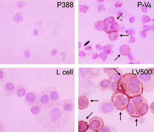 Fig. 3. Immunohistochemical staining of P-gp in parental P388 and the vincristine-treated derivative, P-V4. / Representative results of immunohistochemical staining of P388 (upper left) and P-V4 (upper right). Lower panels show positive (LV500, right) and negative controls (L cell, left). Arrows indicate stained P-gp on the cell surface.