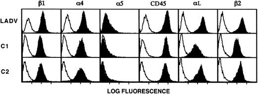 Fig. 5. LADV cells express surface β1 and β2 integrins at levels similar to those on control lymphoblastoid cells. / LADV cells derived from the patient and age-matched control lymphoblastoid cell lines C1 and C2 were analyzed by flow cytometry as described in “Patient, materials, and methods.” Solid profiles indicate staining with the following mAbs: the β1-specific mAb UN29, the α4-specific mAb P4C2, the α5-specific mAb P1D6, the αL-specific mAb BCA1, the β2-specific mAb 60.3, and the CD45-specific mAb H130. Binding of the primary antibodies were detected with FITC-conjugated goat antimouse IgG secondary antibodies (heavy and light chain specific). Open profiles indicate fluorescence of cells incubated with the secondary antibody alone (anti-IgG2a,κ in panels showing staining with anti-β2or anti-αL and anti-IgG1a,κ in all others).