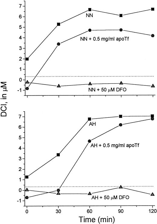 Fig. 7. Apo-Tf extracts Fe from L1-Fe complexes formed in vivo. / Serum samples taken from 2 patients (NN and AH) immediately after L1 administration (▪) (Figure 3) were mixed with apo-Tf (●) or DFO (▴) (final concentrations 0.5 mg/mL and 50 μM, respectively) for 15 minutes at room temperature. The samples were then assayed for DCI as described. Dashed line indicates 0 value.