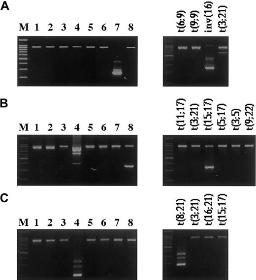 Fig. 1. Examples of fusion genes detected by the multiplex RT-PCR. / Amplification products of 8 parallel multiplex RT-PCR reactions (left panels) and the corresponding split-out reactions (right panels). The product with the higher molecular weight represents the internal positive control, and the lower bands represent the specific fusion genes. (A) inv(16)(p13q22)—CBFB/MYH11 fusion gene. (B) t(15;17)(q21;q22)—PML/RARA. (Note: Due to the primer combinations for the detection of different breakpoints, a few of the translocations detected by the HemaVision kit can appear in more than one master reaction, as seen in lanes 4 and 8. In the right panel of B, split-out reactions correspond to master reaction no.8.) (C) t(8;21)(q22;q22)—AML1/MGT8 (M, 100-bp DNA Ladder (Promega).