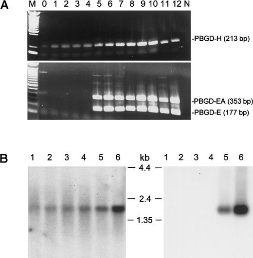 Fig. 2. Confirmation of existence of the PBGD erythroid alternative transcript. / (A) RT-PCR assay of PBGD transcipts. Total RNA from CD34+cells collected on indicated (0-12) days after addition of erythropoietin was used for RT-PCR as described in study design. M: 100-bp DNA ladder (Life Technologies). N: No DNA added control. (B) Northern blot analysis of PBGD-H (left panel) and PBGD-EA (right panel) expression in human hematologic tissues. Lanes 1 to 6 contain, in order, 2 μg polyA+ RNA from human spleen, lymph node, thymus, peripheral blood leukocytes, bone marrow, and fetal liver.32P-labeled probe H (panel A) or probe EA (panel B) was used for hybridization. RNA size marker bands are indicated in between the blots.