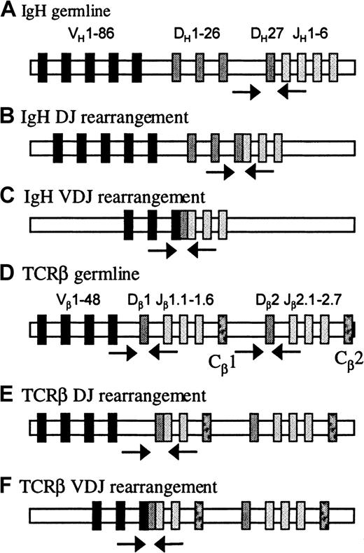 Fig. 1. PCR strategies to type the rearrangement status of human IgH and TCRβ loci. / The human IgH locus harbors about 90 to 123 VH gene segments (depending on haplotype), 27 DH genes, and 6 JH genes. The human TCRβ locus is composed of 65 Vβ gene segments and 2 tandemly arranged D-J-C clusters: the first with 1 Dβ, 6 Jβ, and 1 Cβ genes, the second with 1 Dβ, 7 Jβ, and 1 Cβ genes. (A) IgH germline configuration is detected with a primer upstream of the most 3′ DH element (DH7-27) and the nested JH1 primers. Because DH7-27 is located only 80 base pairs upstream of the JH1 gene segment, the DH7-27–JH primer combination not only detects DH7-27–JH rearrangements but also the germline configuration of the IgH locus. (B) DHJH joints are amplified with a collection of 7 DH-family–specific primers and the nested JH primer mixes. (C) VHDHJH rearrangements are amplified with 6 VH-family–specific primers binding to the framework region 1 of human VH genes and the nested JHprimer mixes. (D) Germline configuration of the TCRβ locus is detected with primers binding intronic sequences 5′ and 3′ of the Dβ1 and Dβ2 genes. (E) DβJβ joints are amplified with the 5′ Dβ primers and nested Jβ primer mixes. (F) TCRβ VDJ rearrangements are amplified with a collection of 24 Vβ-family–specific primers and the 2 Jβprimer mixes. Arrows indicate location of primers.