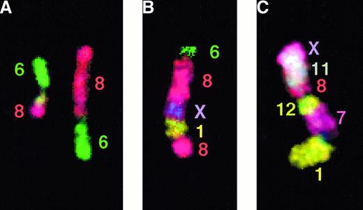 Fig. 1. Multicolor FISH analysis. / (A) Partial multicolor FISH karyotype showing both derivatives of t(6;8)(q15;q24) (patient 37). (B) Complex chromosomal marker identified by multicolor FISH (patient 6), containing 5 different chromosomal fragments (from chromosomes 6, 8, X, 1, and 8). (C) Complex chromosomal marker identified by multicolor FISH (patient 16), containing 6 different chromosomal fragments (from chromosomes X, 11, 8, 12, 7, and 1).