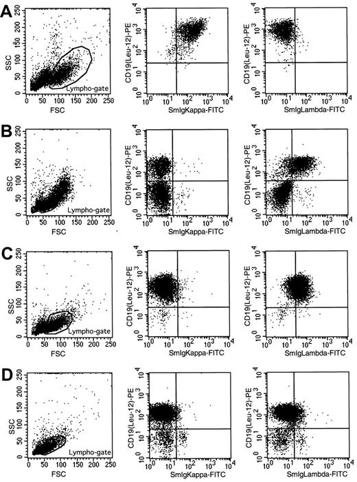 Fig. 1. Flow cytometric immunophenotyping of lymphocytes of 4 B-CLL patients with an in-frame. / IGK and IGL gene rearrangement. (A) CD19+ B lymphocytes of patient 3 express Igκ but not Igλ. Patient 8 (B) and patient 9 (C) express Igλ on CD19+ B lymphocytes, but no Igκ expression is detectable. (D) Patient 10 has low Igλ expression, but Igκ expression is absent.