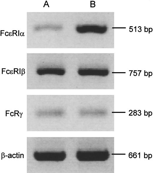 Fig. 2. Expression for α, β, and γ chains of FcεRI mRNA by RT-PCR. / Representative results of RT-PCR analysis for α, β, and γ chains of FcεRI and β-actin mRNA are shown. CB-derived MCs (A) expressed less α but not β or γ chain than PB-derived MCs (B). The density and area of these blots were quantitatively determined by using NIH Imagesoftware version 1.62. The expression ratio of FcεRIα to β-actin in CB-derived MCs was 0.22 ± 0.03 (n = 6), whereas that in PB-derived MCs was 1.76 ± 0.31 (n = 3; P < .05), when the cells were pretreated for 48 hours with IgE but not with IL-4. The ratios of FcεRIβ to β-actin and FcRγ to β-actin in CB-derived MCs were, respectively, 0.16 ± 0.05 and 0.21 ± 0.03 (n = 6). Those in PB-derived MCs were 0.21 ± 0.03 and 0.29 ± 0.04 (n = 3; not significant). Similar results were obtained in IL-4–primed MCs, though FcεRIα to β-actin ratio was enhanced by the cytokine in CB-derived MCs (0.55 ± 0.15; n = 6;P < .05).