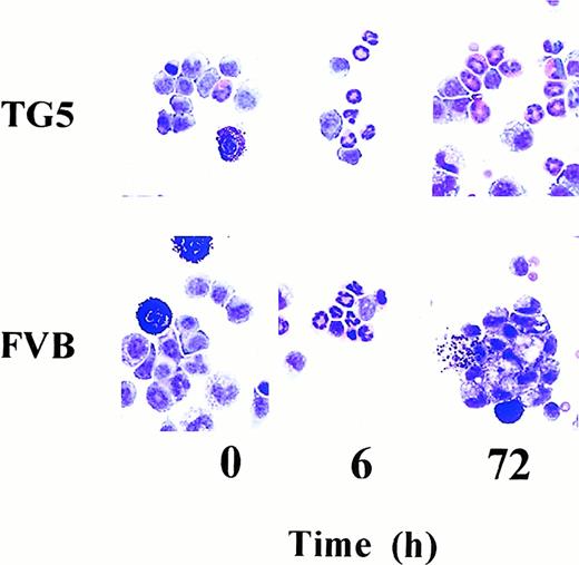 Fig. 1. Cellular content of the peritoneal exudate harvested from TG5 and FVB mice before and after thioglycolate injection. / Photomicrographs of cytospin preparations were made from representative peritoneal lavage samples of IL-9 transgenic (TG5) and wild-type (FVB) mice. Following intraperitoneal injection with thioglycolate, mice were killed at different time points and their peritoneal lavage cellular content was analyzed. At 0 hour time point (before injection) both groups showed macrophages and scattered mast cells (left panels). In addition to these in TG5 mice a few eos are also seen in the peritoneal lavage fluid (upper left panel). Six hours after injection the picture is dominated by neutrophils in FVB and TG5 mice to a similar extent (middle panels). At 72 hours the neutrophils and eos disappeared and were replaced mainly by clustered macrophages in the peritoneal lavage of FVB mice (lower right panel). There was still a significant eosinophilia seen in TG5 mice (upper right panel). Cytospins were prepared and stained with Diff-Quik as described (original magnification × 1000).