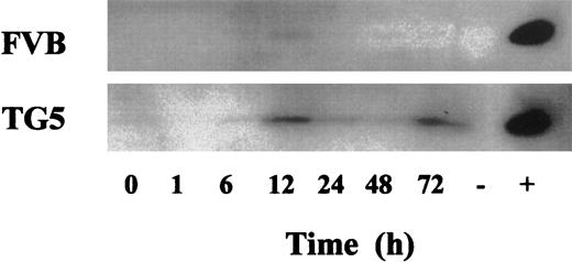 Fig. 3. MBP release in the peritoneal cavity in TG5 and FVB mice. / Representative Western blots of MBP content analysis from peritoneal lavage supernatant samples. Western blots were performed using a rabbit polyclonal antiserum developed in our laboratory as described. Each panel shows protein of expected molecular weight (14 kd) 1, 6, 12, 24, 48, and 72 hours after thioglycolate injection. Eosinophilic cell lysates derived from IL-9 transgenic bone marrow preparations were used as positive controls. Splenic cell lysate preparations were used as negative control.