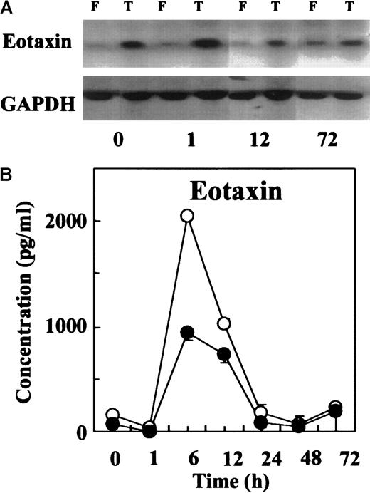 Fig. 4. Eotaxin expression in TG5 and FVB mice. / (A) Representative Northern blots showing eotaxin mRNA production in mesenteric lymph nodes from TG5 (T) and FVB (F) mice. Mesenteric lymph nodes were harvested before and 1, 12, and 72 hours after thioglycolate injection. Hybridization with a GAPDH probe confirmed that comparable amounts of RNA had been loaded in each lane. (B) Time course of immunoreactive eotaxin protein release in the peritoneal lavage was analyzed using ELISA. Supernate samples were harvested before and 1, 6, 12, 24, 48, and 72 hours after thioglycolate injection, respectively. Values are expressed in pg/mL as mean ± SEM (n = 4 for each time point and each genotype). Open circles indicate cell numbers in FVB mice; solid circles, cell numbers in TG5 mice.