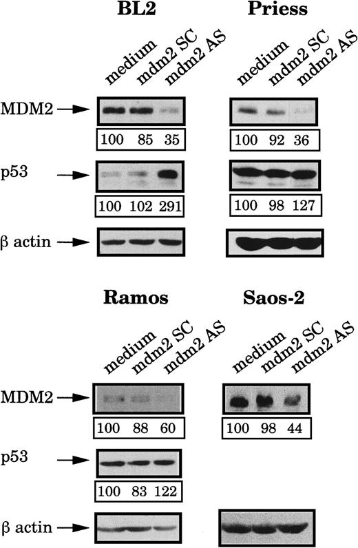 Fig. 2. Analysis of MDM2 and p53 protein levels after mdm2 AS electropermeabilization. / BL2, Priess, Ramos, and Saos-2 cells were electroporated with either mdm2 AS, a control scrambled (SC) oligonudeoxycleotide, or medium and cultured for 4 hours before being analyzed by Western blot using IF2 anti-MDM2 mAb or DO1 anti-p53 mAb. The blots were subsequently hybridized with AC-74 anti-β-actin mAb to verify loading. The level of protein expression indicated below each band was obtained by densitometry following normalization for β-actin expression.