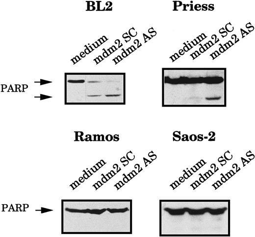 Fig. 3. Analysis of the PARP cleavage after mdm2 AS electropermeabilization. / BL2, Priess, Ramos, and Saos-2 cells were electroporated with either mdm2 AS, a control scrambled (SC) oligodeoxynucleotide, or medium and cultured for 20 hours before being analyzed by Western blot using C2-10 anti-PARP mAb.