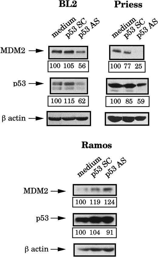 Fig. 4. Analysis of the p53 and MDM2 protein levels after p53 AS electropermeabilization. / BL2, Priess, and Ramos cells were electroporated with either p53 AS, a control scrambled (SC) oligodeoxynucleotide, or medium and cultured for 4 hours before being analyzed by Western blot using IF2 anti-MDM2 mAb and DO1 anti-p53 mAb. The blots were subsequently hybridized with AC-74 anti-β-actin mAb to verify loading. The level of protein expression indicated below each band was obtained by densitometry following normalization for β-actin expression.