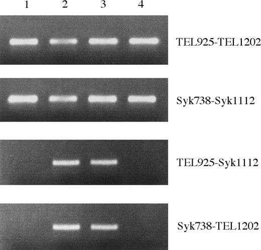 Fig. 4. Identification of TEL-Syk and Syk-TEL by RT-PCR. / RNA samples derived from the patient's BM mononuclear cells at initial diagnosis (lane 2), remission phase (lane 3), and postallogeneic BM transplantation day 220 (lane 4) and from HL-60 (lane 1) were reverse transcribed. Aliquots of cDNAs were amplified with the following primers: 5′ and 3′ TEL, 5′ and 3′ Syk, 5′ TEL and 3′ Syk, and 5′ Syk and 3′ TEL.