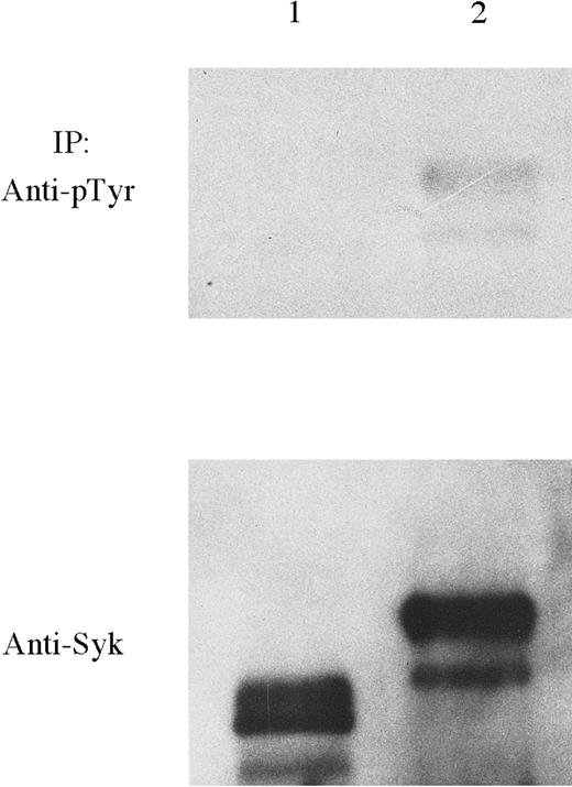 Fig. 7. TEL-Syk is constitutively tyrosine-phosphorylated in COS-7 cells. / COS-7 cells were transfected with pFlag-TELΔ PNT-Syk (lane 1) or TEL-Syk (lane 2), lysed, and immunoprecipitated with a mAb to Syk. Immunoprecipitants were then separated by SDS-PAGE, transferred to PVDF membrane, and blotted using HRP-conjugated tyrosine-phosphorylated antibody (PY20) and enhanced chemiluminescence (ECL) detection methods. Stripping and reprobing were performed using a mAb to Syk. Both proteins were immunoprecipitated.