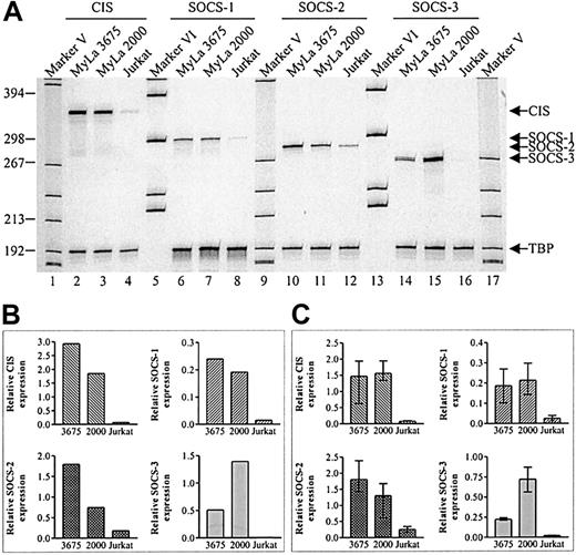 Fig. 1. Constitutive expression of SOCS mRNA in MF tumor cell lines. / (A) Total cellular RNA was isolated from unstimulated cells and subjected to RT-PCR with the indicated SOCS primers. As internal standard primers specific for TBP were used. (B) Band intensities from the gel in panel A were quantitated using a phosphor imager and SOCS expression was calculated relative to TBP expression. (C) Relative SOCS expression calculated from 3 independent experiments (mean + range).