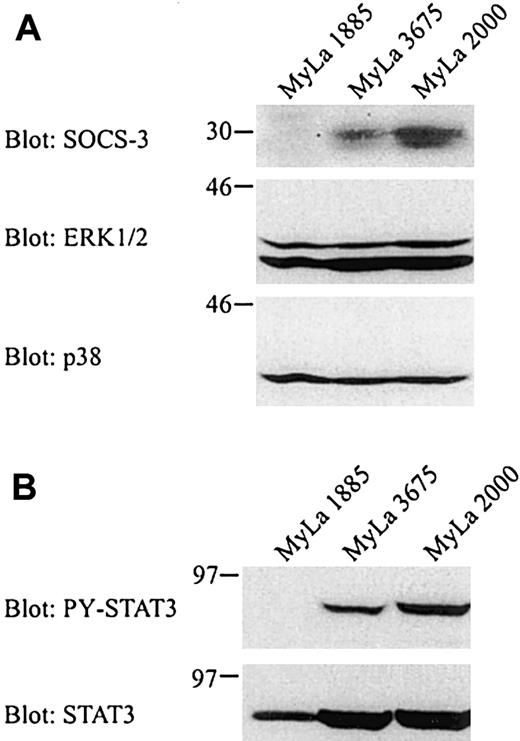 Fig. 2. Expression of SOCS-3 protein correlates with STAT3 activation. / Unstimulated cells were lysed and whole cell lysates from 1 × 106 cells (A) or 0.5 × 106 cells (B) were subjected to Western blotting with the indicated antibodies.