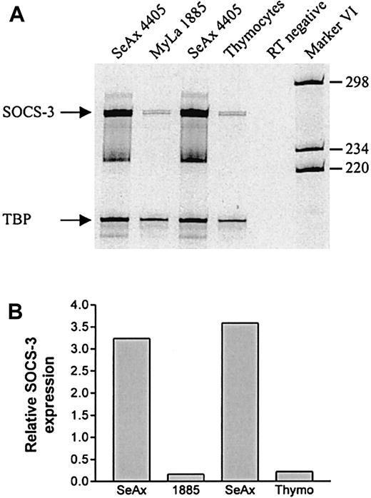 Fig. 3. High expression of SOCS-3 mRNA in SeAx 4405 cells. / (A) Total cellular RNA was isolated from unstimulated cells and subjected to RT-PCR with SOCS-3 and TBP-specific primers. The RT-negative sample was treated as the other samples except that RT was not added in the cDNA synthesis. The RNA samples used in lanes 1 and 3, respectively, were from 2 independent experiments. (B) Band intensities from the gel in panel A were quantitated and SOCS-3 expression was calculated relative to TBP expression.