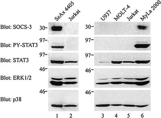 Fig. 4. Constitutive SOCS-3 protein expression in CTCL tumor cell lines. / Unstimulated cells were lysed and whole cell lysates from 1 × 106 cells (140 μg protein of U937 and MOLT-4 lysates) were loaded onto 2 separate sodium dodecyl sulfate-polyacrylamide gels, run separately, and analyzed separately by Western blotting with the indicated antibodies.