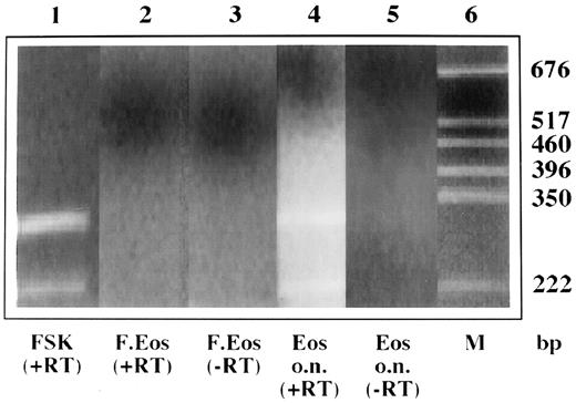 Fig. 1. Eosinophils express mRNA for SCF. / RNA was extracted from 5 × 106 fresh eosinophils (F. Eos) and eosinophils cultured overnight with enriched medium alone (Eos o.n.). As a positive control, total RNA from human foreskin fibroblasts (FSK) was used. As a negative control, a sample was obtained in the presence of water instead of reverse transcriptase (−RT). RNA was reverse-transcribed to cDNA and amplified with specific primers for SCF. The products were electrophoresed on a 1.8% agarose gel and then were stained with ethidium bromide. Molecular weight marker (D-15 marker NOVEX) was electrophoresed simultaneously with other PCR products (M).