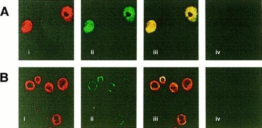 Fig. 3. Eosinophils display cytoplasmic and cell membrane-staining patterns for SCF. / (A) Representative eosinophils with the Texas red channel corresponding to SCF (i), the FITC channel corresponding to MBP (ii), and combined fluorescence (iii). (B) Representative eosinophils with the Texas red channel corresponding to SCF (i), the FITC channel corresponding to c-Kit (ii), and combined fluorescence (iii). Isotype controls displayed minimal fluorescence background after subtraction of autofluorescence (Aiv and Biv). Original magnification, ×63. Control cells consisted of foreskin fibroblasts and HMC-1. Foreskin fibroblasts showed an intense membranal staining of SCF and were negative for c-Kit, whereas HMC-1 displayed intense membrane staining and weak, diffuse cytoplasmic staining for SCF that did not colocalize with the c-Kit receptors (not shown).