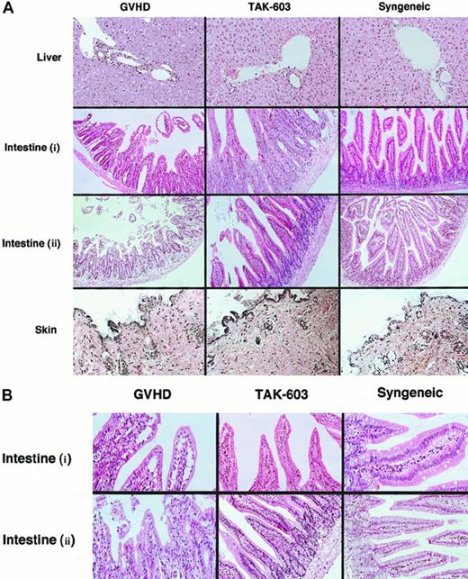 Fig. 2. Histopathologic examination. / Induction of lethal acute GVHD and administration of TAK-603 were performed as described in “Materials and methods.” On day 6, 3 mice from each of the 6 groups were killed. Paraffin sections of the skin, liver, and small intestine were stained by hematoxylin and eosin (original magnification: A, × 200; B, × 400. Intestine (i): intestine from BALB/c mice receiving 2 × 107 nucleated BM cells and 1 × 107 nucleated spleen cells. Intestine (ii): intestine from BALB/c mice receiving 2 × 107nucleated BM cells and 5 × 107 nucleated spleen cells.