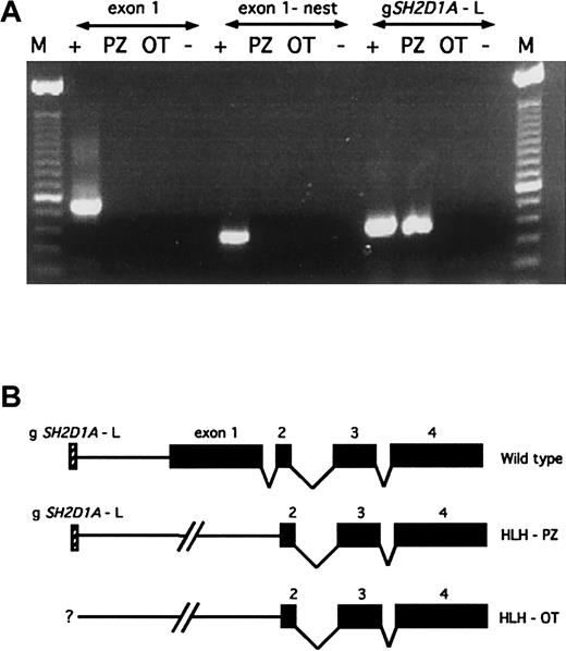 Fig. 1. Interstitial deletions encompassing SH2D1Aexon 1 are present in patients HLH-PZ and HLH-OT. / (A) Nested PCR analysis of SH2D1A exon 1 reveals no detectable product in patients HLH-PZ or HLH-OT, in comparison to a normal patient (denoted as “+”), indicating the presence of interstitial genomic deletions. Amplification of the centromeric sequence gSH2D1A-L reveals a product in patient HLH-PZ, establishing an approximate centromeric boundary for the deletion in this patient. The gSH2D1A-L is absent in HLH-OT, indicating the presence of a larger deletion, the centromeric boundary of which was not further mapped. “M” denotes the 123-base pair (bp) ladder, and “−” the negative control (no input DNA). (B) Schematic representation of the wild-type SH2D1A genomic locus and the constitutional deletions in these patients. SH2D1A exons are shown as black boxes, and the gSH2D1A-L marker as a hatched box.