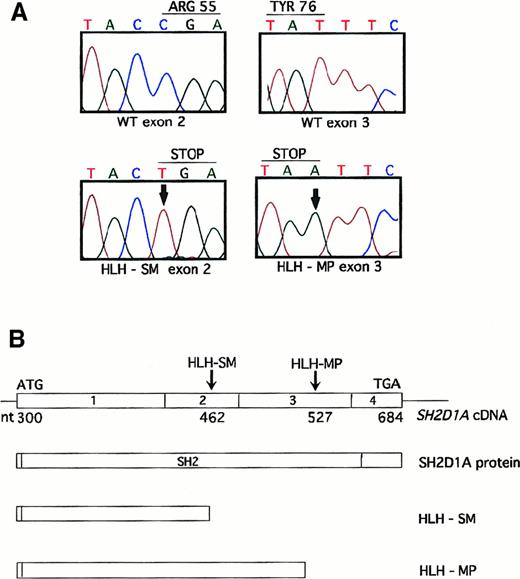 Fig. 2. Unique nonsense mutations are identified in patients HLH-SM and HLH-MP. / (A) Automated sequence analysis of exon 2 reveals a C462T nucleotide substitution (shown with an arrow) in patient HLH-SM (lower left-hand panel), that is predicted to substitute a stop codon for Arg55. Similarly, sequence analysis of exon 3 reveals a T527A nucleotide change in patient HLH-MP (lower right-hand panel), changing Tyr76 to a stop codon. (B) Schematic representation of the full-length SH2D1A complementary DNA and protein, and the location of both point mutations that are predicted to result in premature truncation within the SH2D1A SH2 domain.