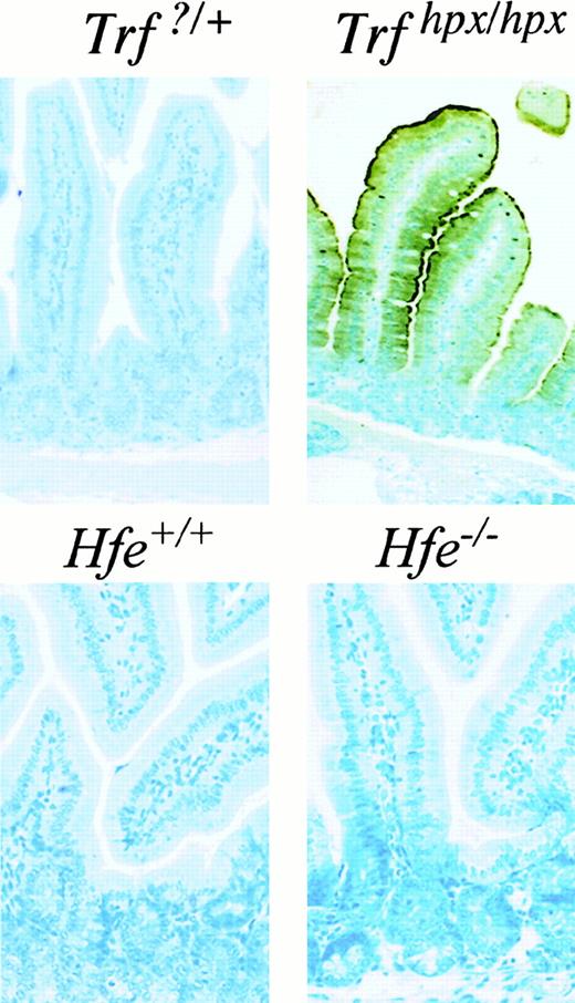 Fig. 2. Immunohistochemical staining of DMT1 in the intestine of. / Trfhpx/hpx andHfe−/− mice. Magnified (400×) tissue sections from the proximal duodenum ofTrf?/+,Trfhpx/hpx,Hfe+/+, and Hfe−/− mice were immunostained with polyclonal rabbit anti-mouse DMT1 N-terminus antibody (dilution 1:40). DMT1 detection produces dark brown staining.